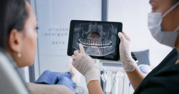 Licensed Teeth Whitening service in Golden Valley County County, ND - Smile Center Dentistry